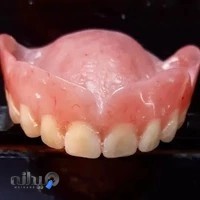 دندانسازی آیت اله پیرهادی