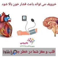 کلینیک تست خواب شمال تهران