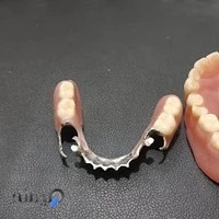 دندانسازی ملاشاهی