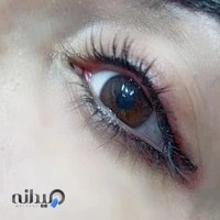 میکروبلیدینگ نیلوفر ثموری