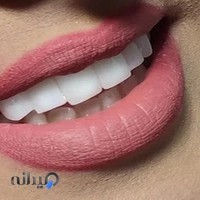 مطب دکتر رامین ولیپور