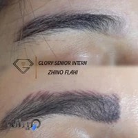 ریمو تتو سنندج