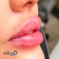 مرکز لیزر و زیبائی میتاش