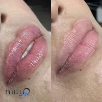 کلینک پوست و زیبایی دلورا