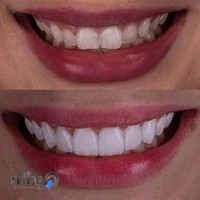 کلینیک دندان سازی