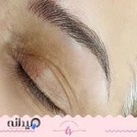 میکروبلیدینگ سوپرنچرال ابرو در کرج