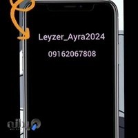 لیزر موهای زايدآیرا