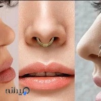 مرکز لیزر الماس ایلام