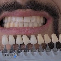 استودیو لبخند بجنورد (دندانپزشکی دکتر سید مهدی سعیدی)