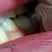 لابراتوار تخصصی دندانسازی داوود یوسفی