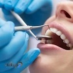 Mary Dent مطلب دندانپزشکی دکتر مریم فتحی