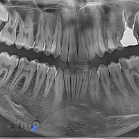 رادیولوژی دکترابراهیم صادقی،تخصصی فک وصورت