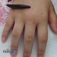 طب سنتی جوان