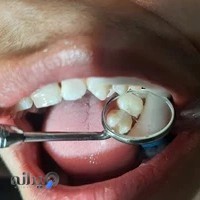 مرکز دندانپزشکی دکتر پریسا پرکار