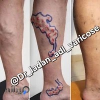 کلینیک واریس دکتر عدل