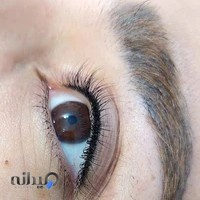 میکروبلیدینگ lida