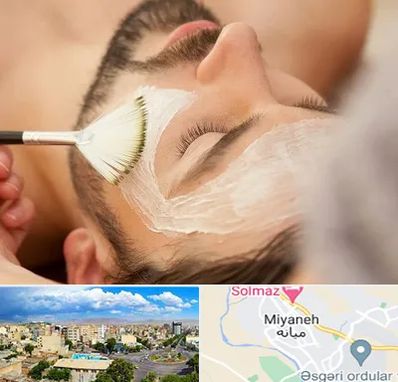 فیشیال صورت آقایان در میانه