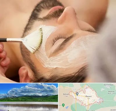 فیشیال صورت آقایان در مرند