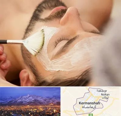 فیشیال صورت آقایان در کرمانشاه