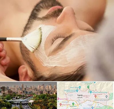 فیشیال صورت آقایان در منطقه 1 تهران