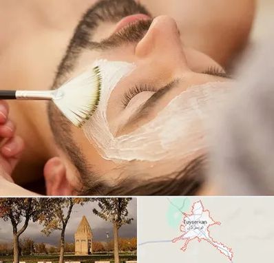 فیشیال صورت آقایان در تویسرکان