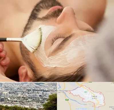 فیشیال صورت آقایان در یاسوج