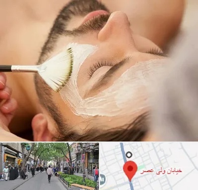 فیشیال صورت آقایان در ولیعصر شهریار