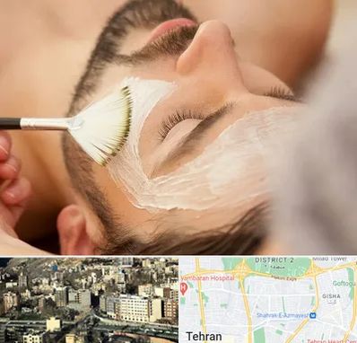 فیشیال صورت آقایان در مرزداران