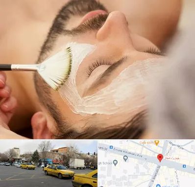 فیشیال صورت آقایان در شهناز تبریز