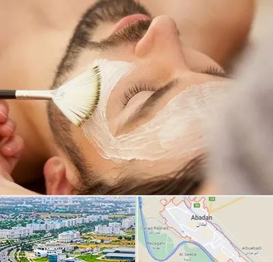 فیشیال صورت آقایان در آبادان