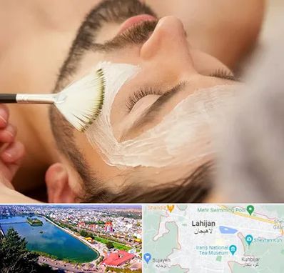 فیشیال صورت آقایان در لاهیجان