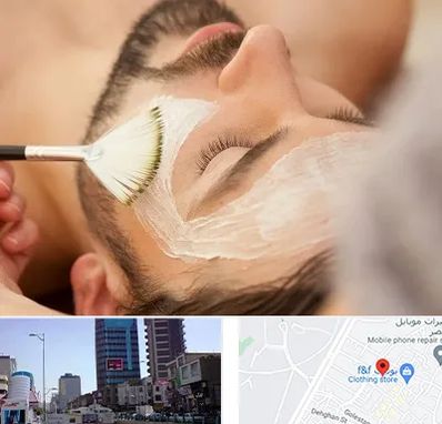 فیشیال صورت آقایان در چهارراه طالقانی کرج