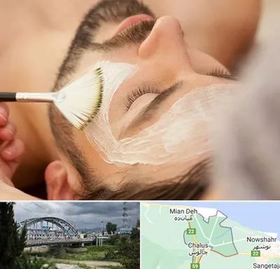 فیشیال صورت آقایان در چالوس