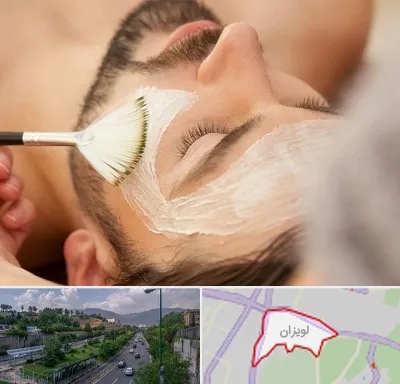 فیشیال صورت آقایان در لویزان