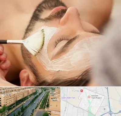 فیشیال صورت آقایان در فاز سه اندیشه