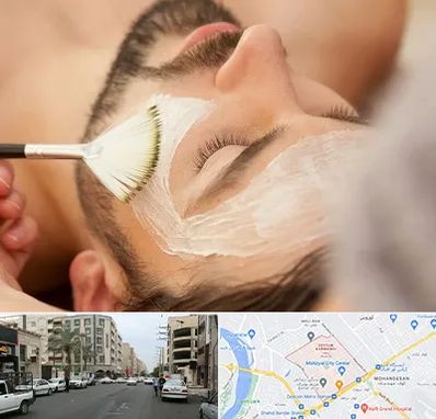 فیشیال صورت آقایان در زیتون کارمندی اهواز