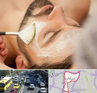 فیشیال صورت آقایان در امیرآباد