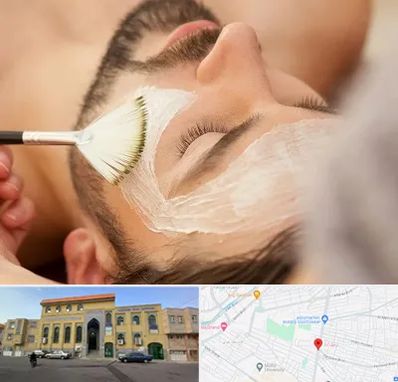 فیشیال صورت آقایان در زنبیل آباد قم