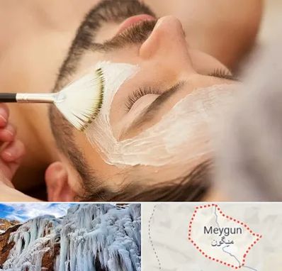 فیشیال صورت آقایان در میگون