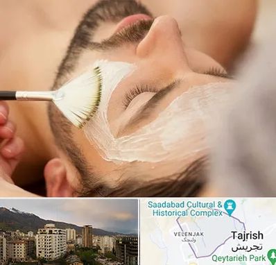 فیشیال صورت آقایان در زعفرانیه