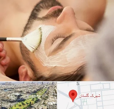 فیشیال صورت آقایان در شهرک گلستان