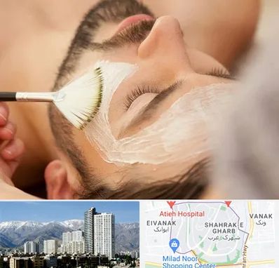 فیشیال صورت آقایان در شهرک غرب