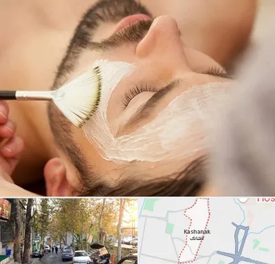 فیشیال صورت آقایان در کاشانک