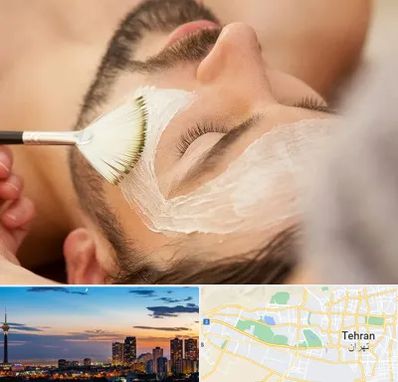 فیشیال صورت آقایان در غرب تهران