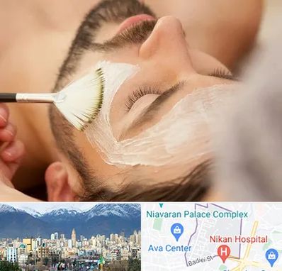 فیشیال صورت آقایان در آجودانیه