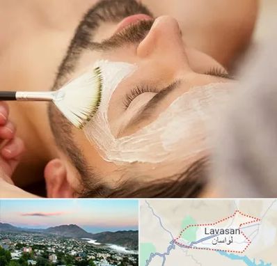 فیشیال صورت آقایان در لواسان