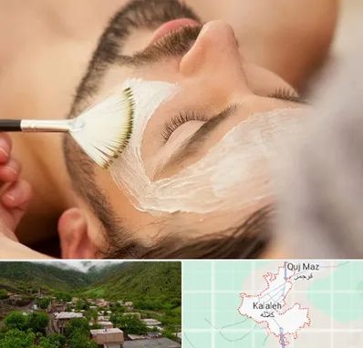 فیشیال صورت آقایان در کلاله