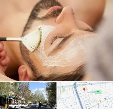 فیشیال صورت آقایان در کوی فیروز تبریز