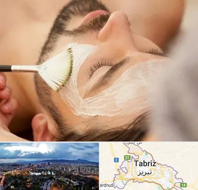 فیشیال صورت آقایان در تبریز