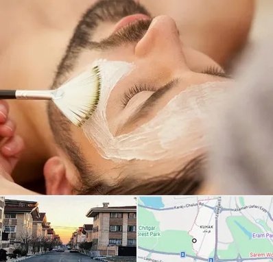 فیشیال صورت آقایان در کوهک